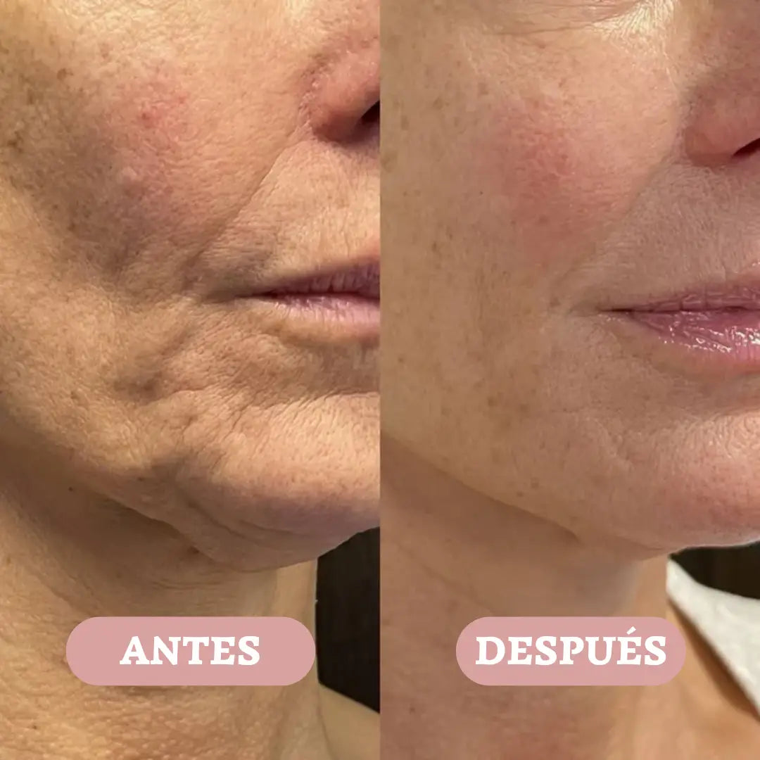 Kahi® │TU SECRETO COREANO ANTIARRUGAS