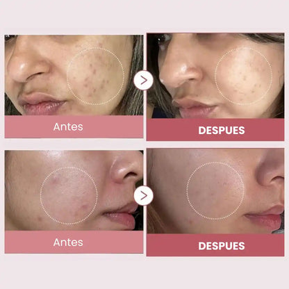 Repair® KIT ANTIEDAD PREMIUM